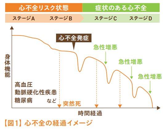 心不全のイメージ